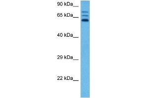Western Blotting (WB) image for anti-Cystathionine-beta-Synthase (CBS) (N-Term) antibody (ABIN2782348)