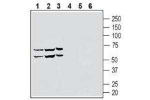 Western blot analysis of human THP-1 monocytic leukemia cell line lysate (lanes 1 and 4), human NK-92 natural killer cell line lysate (lanes 2 and 5) and human HL-60 promyelocytic leukemia cell line lysate (lanes 3 and 6) lysates: - 1-3. (S1PR5 抗体  (Extracellular, N-Term))