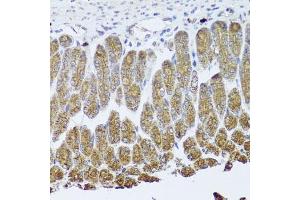 Immunohistochemistry of paraffin-embedded mouse stomach using NTRK1 Antibody (ABIN5971124) at dilution of 1/100 (40x lens). (TRKA 抗体)