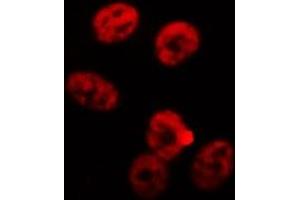 ABIN6268811 staining K-562 cells by IF/ICC.