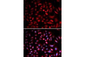 Immunofluorescence analysis of U2OS cells using PRKACB antibody.
