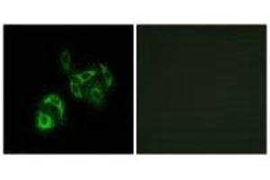 Immunofluorescence analysis of A549 cells, using SLC27A4 antibody. (SLC27A4 抗体)