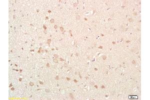 Formalin-fixed and paraffin embedded rat brain labeled with Anti-NKB Polyclonal Antibody, Unconjugated (ABIN724460) at 1:200 followed by conjugation to the secondary antibody and DAB staining (Tachykinin 3 抗体  (AA 81-90))