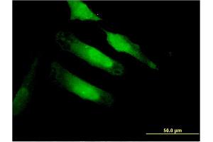 Immunofluorescence of monoclonal antibody to CA10 on HeLa cell. (CA10 抗体  (AA 229-328))