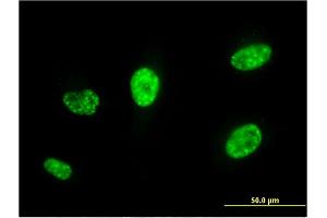 Immunofluorescence of monoclonal antibody to PCGF5 on HeLa cell. (PCGF5 抗体  (AA 51-148))