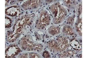 Image no. 4 for anti-V-Akt Murine Thymoma Viral Oncogene Homolog 1 (AKT1) antibody (ABIN1496556) (AKT1 抗体)