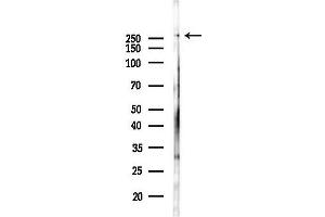 anti-ATP-Binding Cassette, Sub-Family A (ABC1), Member 1 (ABCA1) (C-Term) antibody
