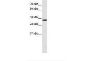 Image no. 1 for anti-Excision Repair Cross-Complementing Rodent Repair Deficiency, Complementation Group 8 (ERCC8) (AA 37-86) antibody (ABIN6736089) (ERCC8 抗体  (AA 37-86))