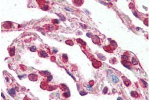 Human Lung (formalin-fixed, paraffin-embedded) stained with CCR3 antibody ABIN461875 at 2. (CCR3 抗体  (N-Term))