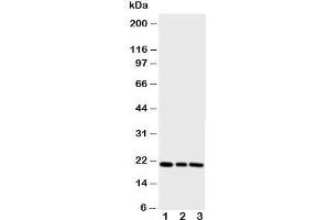 Western blot testing of PBP antibody and Lane 1:  rat brain;  2: (r) lung;  3: (r) liver (PEBP1 抗体  (N-Term))