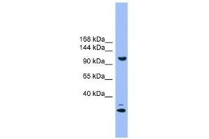 Western Blot showing STARD8 antibody used at a concentration of 1. (STARD8 抗体  (N-Term))