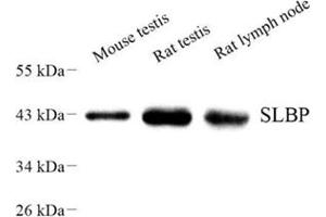 Western blot analysis of SLBP (ABIN7075733) at dilution of 1: 500 (SLBP 抗体)