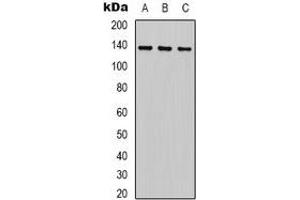 Western blot analysis of HER2 expression in HEK293T (A), 22RV1 (B), Hela (C) whole cell lysates. (ErbB2/Her2 抗体)