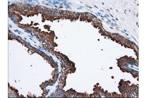 Immunohistochemical staining of paraffin-embedded Human prostate tissue using anti-PANK2 mouse monoclonal antibody. (PANK2 抗体)