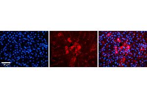 Rabbit Anti-METTL5 Antibody Catalog Number: ARP54982_P050 Formalin Fixed Paraffin Embedded Tissue: Human Liver Tissue Observed Staining: Cytoplasm in hepatocytes and sinusoids Primary Antibody Concentration: 1:100 Other Working Concentrations: 1:600 Secondary Antibody: Donkey anti-Rabbit-Cy3 Secondary Antibody Concentration: 1:200 Magnification: 20X Exposure Time: 0. (METTL5 抗体  (N-Term))