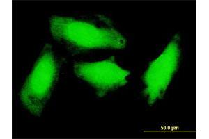 Immunofluorescence of monoclonal antibody to GCH1 on HeLa cell. (GCH1 抗体  (AA 1-250))