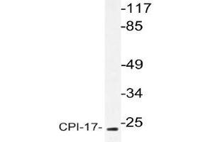 Western blot (WB) analysis of CPI-17 antibody in extracts from HT-29 cells .