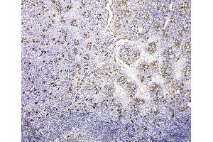 IHC analysis of IGLL1 using anti-IGLL1 antibody (ABIN6719329).