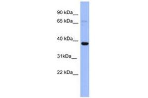 Image no. 1 for anti-Immediate Early Response 5 (IER5) (N-Term) antibody (ABIN6741712) (IER5 抗体  (N-Term))
