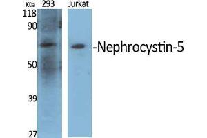 Western Blot (WB) analysis of specific cells using Nephrocystin-5 Polyclonal Antibody. (IQCB1 抗体  (Internal Region))