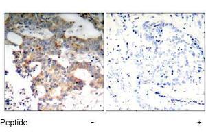 Image no. 1 for anti-Nuclear Factor of kappa Light Polypeptide Gene Enhancer in B-Cells Inhibitor, epsilon (NFKBIE) (Ser22) antibody (ABIN197570) (NFKBIE 抗体  (Ser22))