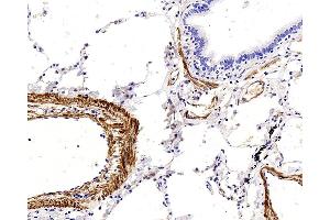 Immunohistochemistry (Paraffin-embedded Sections) (IHC (p)) image for anti-Transgelin (TAGLN) antibody (ABIN7249760)