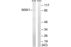 Western blot analysis of extracts from mouse brain cells, using MSK1 (epitope around residue 212) antibody. (MSK1 抗体  (Ser212))