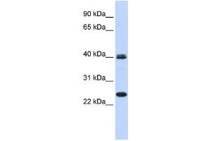 Western Blotting (WB) image for anti-Mesoderm Posterior 1 (MESP1) antibody (ABIN2458389) (MESP1 抗体)