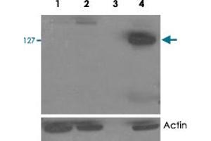 HEK293 overexpressing TANK2 (lane 4) and TANK1 (lane 2) and probed with TNKS2 polyclonal antibody  (mock transfection in first lane). (TNKS2 抗体)