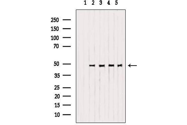 Mu Opioid Receptor 1 抗体  (C-Term)