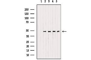 Western blot analysis of extracts from various samples, using OPRM1 Antibody. (Mu Opioid Receptor 1 抗体  (C-Term))