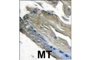 Formalin-fixed and paraffin-embedded human muscle tissue tissue reacted with PI3CKG antibody (C-term) (ABIN392816 and ABIN2842247) , which was peroxidase-conjugated to the secondary antibody, followed by DAB staining. (PIK3 gamma 抗体  (C-Term))