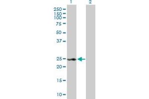 Western Blot analysis of RAD54B expression in transfected 293T cell line by RAD54B MaxPab polyclonal antibody. (RAD54B 抗体  (AA 1-158))