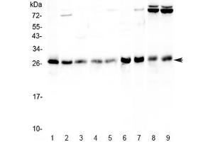 Western blot testing of human 1) HeLa, 2) Jurkat, 3) MCF7, 4) HepG2, 5) A549, 6) rat stomach, 7) rat thymus, 8) mouse thymus and 9) mouse NIH3T3 lysate with RAB27A antibody at 0.