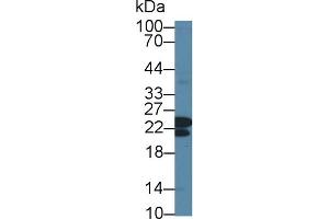 Detection of CBFb in Human Jurkat cell lysate using Polyclonal Antibody to Core Binding Factor Beta Subunit (CBFb)