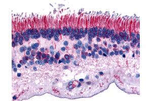 Immunohistochemistry (IHC) image for anti-Protein Tyrosine Phosphatase, Receptor Type, M (PTPRM) (Internal Region) antibody (ABIN1049278)