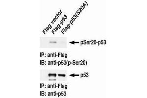 Western Blotting (WB) image for anti-Tumor Protein P53 (TP53) (pSer20) antibody (ABIN1449251) (p53 抗体  (pSer20))
