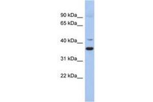 Image no. 1 for anti-Glutamate Decarboxylase-Like 1 (GADL1) (AA 215-264) antibody (ABIN6743948) (GADL1 抗体  (AA 215-264))