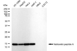 Western blotting analysis using Natriuretic peptide A antibody (ABIN7799559).