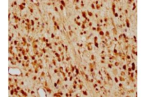 IHC image of ABIN7127421 diluted at 1:97. (Recombinant CDKN1B 抗体)