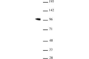 SOX6 antibody (pAb) tested by Western blot. (SOX6 抗体  (AA 1-20))