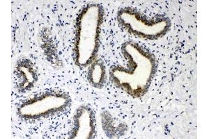 IHC analysis of HSD17B4 using anti- HSD17B4 antibody . (HSD17B4 抗体  (AA 510-736))