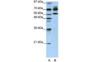 WB Suggested Anti-ADARB1 Antibody Titration:  1. (RED1 抗体  (N-Term))