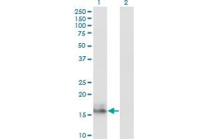 Western Blot analysis of AGR2 expression in transfected 293T cell line by AGR2 monoclonal antibody (M01A), clone 1E5. (AGR2 抗体  (AA 1-175))