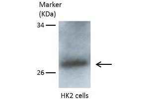 Western Blotting (WB) image for anti-ClpP Caseinolytic Peptidase, ATP-Dependent, Proteolytic Subunit Homolog (E. Coli) (CLPP) (C-Term) antibody (ABIN2855887)