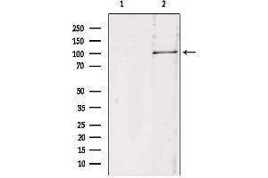 Western blot analysis of extracts from 293, using RBM15 antibody.