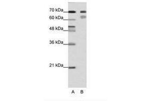 Image no. 1 for anti-Transcription Factor 3 (E2A Immunoglobulin Enhancer Binding Factors E12/E47) (TCF3) (N-Term) antibody (ABIN202854) (TCF3 抗体  (N-Term))