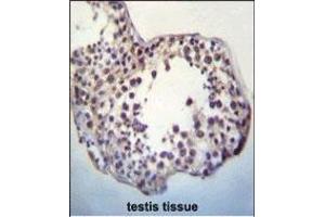 TPTEa Antibody (N-term) (ABIN652246 and ABIN2841038) immunohistochemistry analysis in formalin fixed and paraffin embedded human testis tissue followed by peroxidase conjugation of the secondary antibody and DAB staining. (TPTEa 抗体  (N-Term))