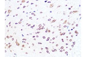 Immunohistochemistry of paraffin-embedded mouse spinal cord using Lamin B2 Rabbit mAb (ABIN1679310, ABIN3019324, ABIN3019325 and ABIN7101750) at dilution of 1:100 (40x lens). (Lamin B2 抗体)