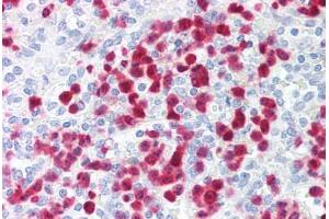 Human Spleen, Neutrophils (formalin-fixed, paraffin-embedded) stained with S100A8 antibody ABIN214203 at 2. (S100A8 抗体)